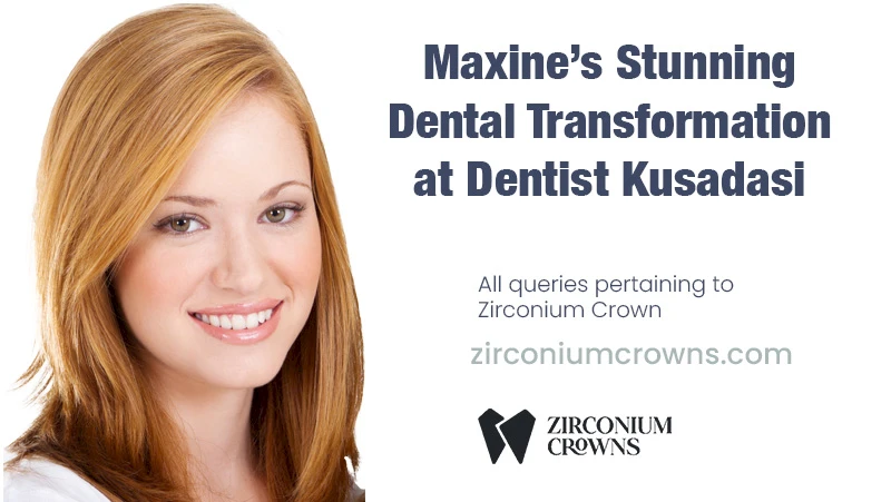 Maxine’s Stunning Dental Transformation at Dentist Kusadasi