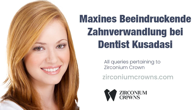 Maxines Beeindruckende Zahnverwandlung bei Dentist Kusadasi