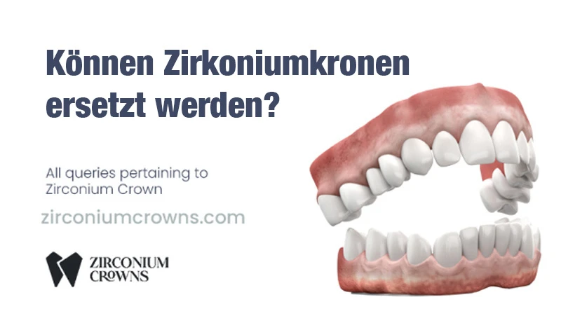 Können Zirkoniumkronen ersetzt werden?