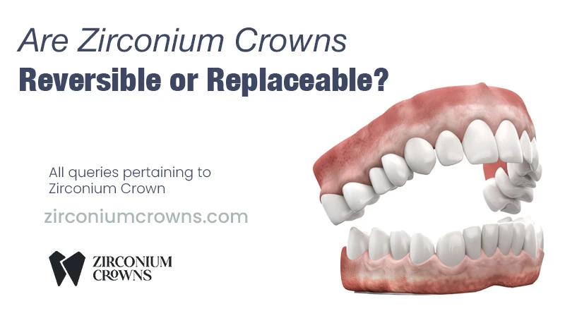 Are Zirconium Crowns Reversible or Replaceable?