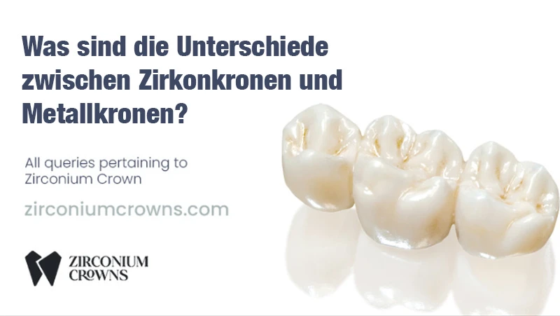 Was sind die Unterschiede zwischen Zirkonkronen und Metallkronen?