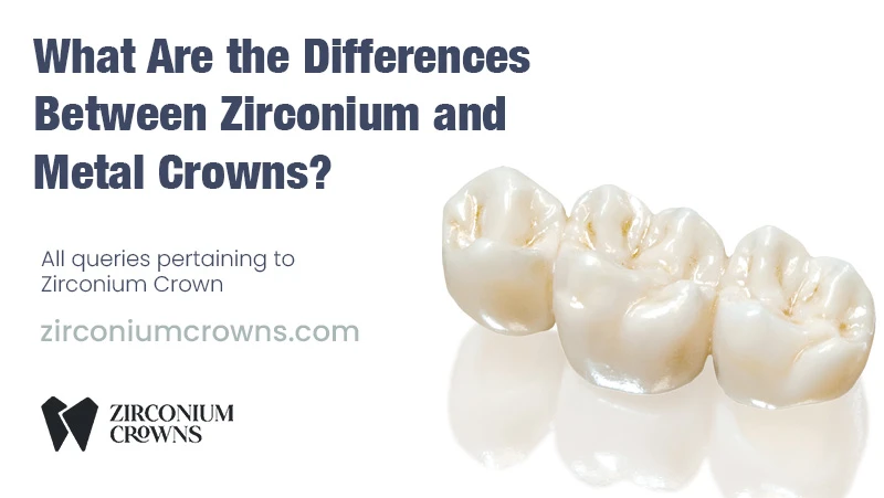 What Are the Differences Between Zirconium and Metal Crowns?