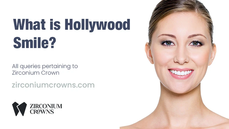 What is Hollywood Smile?