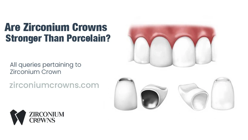 Are Zirconium Crowns Stronger Than Porcelain?​