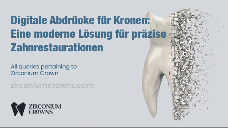 Digitale Abdrücke für Kronen: Eine moderne Lösung für präzise Zahnrestaurationen