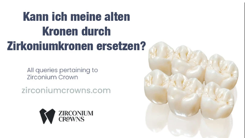 Kann ich meine alten Kronen durch Zirkoniumkronen ersetzen?