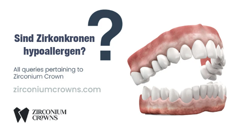 Sind Zirkonkronen hypoallergen?