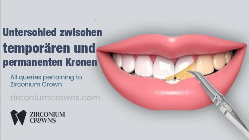 Temporäre vs. Permanente Kronen: Was ist der Unterschied?