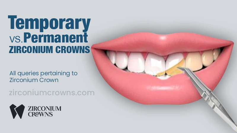 Temporary vs. Permanent Crowns: What’s the Difference?