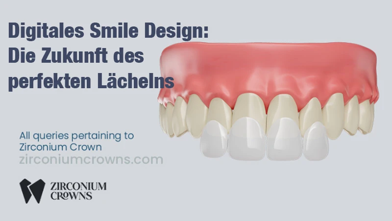 Digitales Smile Design: Die Zukunft des individuellen Lächelns
