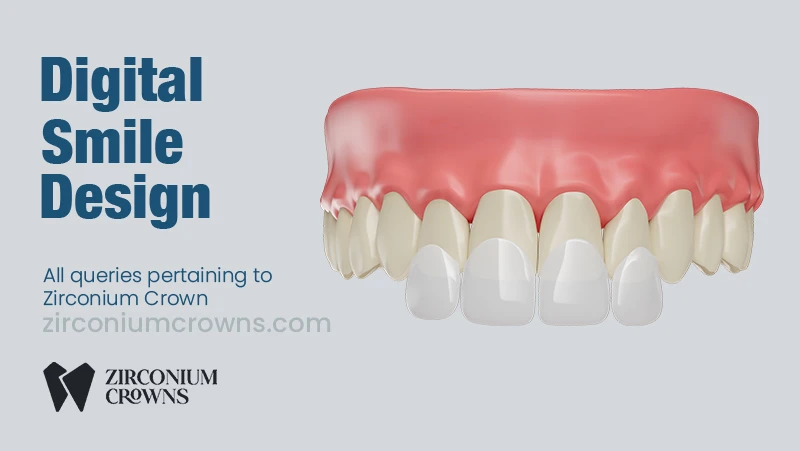 Digital Smile Design: The Future of Personalized Smiles